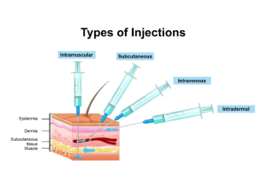 Types of Injection